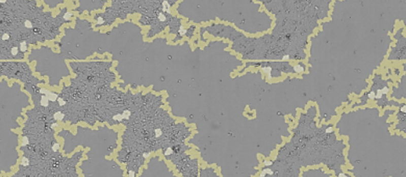 黑曲霉孢子(生殖细胞)。黑曲霉真菌是一种广泛分布的腐生植物，生长在家庭灰尘，土壤和腐烂的植物物质，包括陈腐的食物。黑曲霉是引起真菌性耳部感染的最常见原因之一，可能导致免疫功能受损或其他肺部疾病的人患上严重的肺曲霉病。除其他工业用途外，黑曲霉还用于废物管理和生物转化，如生产柠檬酸和细胞外酶。彩色扫描电子显微照片(SEM)，打印宽10cm时放大x1500倍。