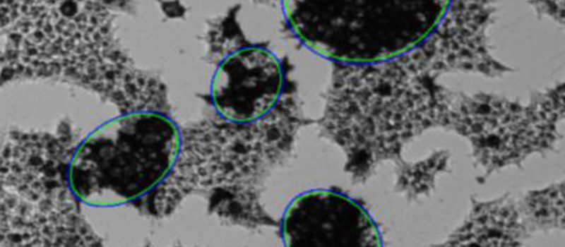 黑曲霉孢子(生殖细胞)。黑曲霉真菌是一种广泛分布的腐生植物，生长在家庭灰尘，土壤和腐烂的植物物质，包括陈腐的食物。黑曲霉是引起真菌性耳部感染的最常见原因之一，可能导致免疫功能受损或其他肺部疾病的人患上严重的肺曲霉病。除其他工业用途外，黑曲霉还用于废物管理和生物转化，如生产柠檬酸和细胞外酶。彩色扫描电子显微照片(SEM)，打印宽10cm时放大x1500倍。